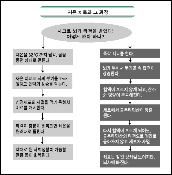 뇌 저온 치료법